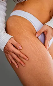 vEndymed, Endymed pro, Endymed Pure, Radiofrequência, 3DEEP, iFINE, Intensif, Mini Shaper, Small, Contour, Shaper, FSR, SKIN RESURFACING, BODY CONTOURING, FACIAL TIGHTENING, MICROAGULHAMENTO DE OURO