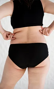 Endymed, Endymed pro, Endymed Pure, Radiofrequência, 3DEEP, iFINE, Intensif, Mini Shaper, Small, Contour, Shaper, FSR, SKIN RESURFACING, BODY CONTOURING, FACIAL TIGHTENING, MICROAGULHAMENTO DE OURO