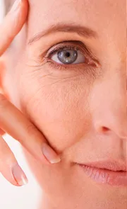 Endymed, Endymed pro, Endymed Pure, Radiofrequência, 3DEEP, iFINE, Intensif, Mini Shaper, Small, Contour, Shaper, FSR, SKIN RESURFACING, BODY CONTOURING, FACIAL TIGHTENING, MICROAGULHAMENTO DE OURO